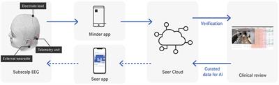 Seizure Forecasting Using a Novel Sub-Scalp Ultra-Long Term EEG Monitoring System